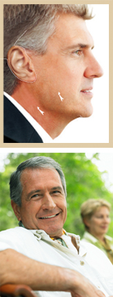 Male Aesthetic Surgery - Facelift