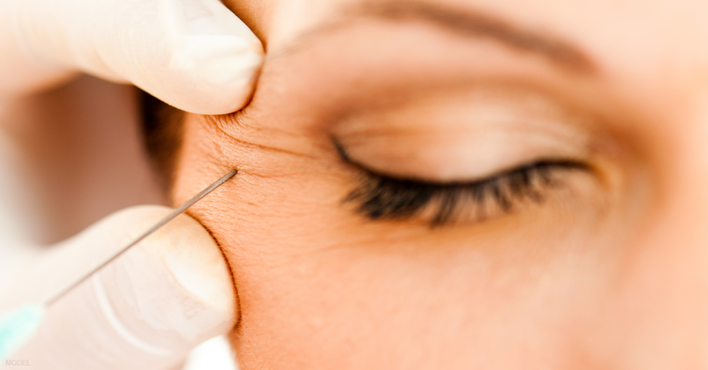 A patient receives a BOTOX® injection.
