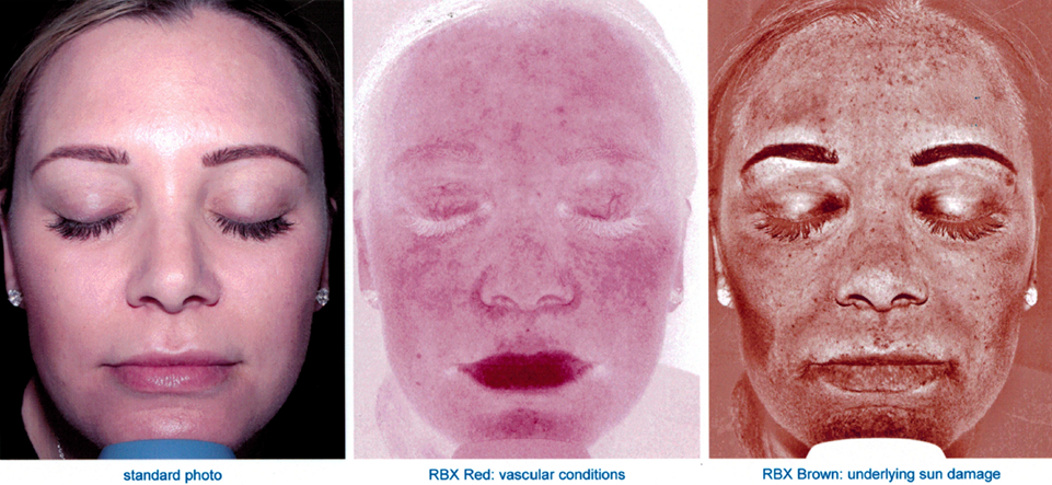 reveal imager used on woman's face